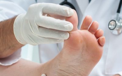 The Importance of Treating Toe Pain