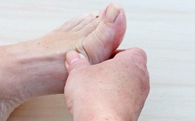 Signs & Symptoms of Rheumatoid Arthritis of the Feet