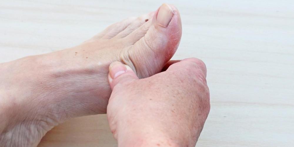 Signs & Symptoms of Rheumatoid Arthritis of the Feet